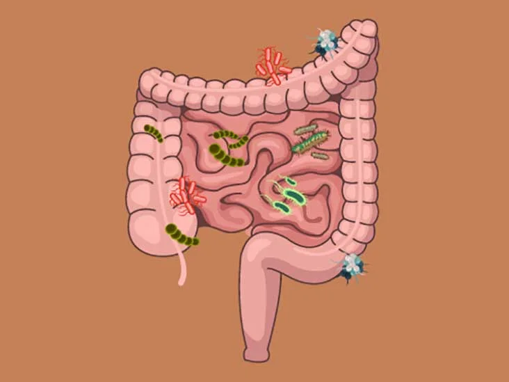 The importance of gut health